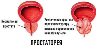 Изображение 2 Изображение 2