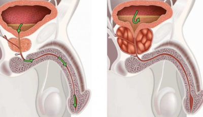 Изображение 1 Изображение 1