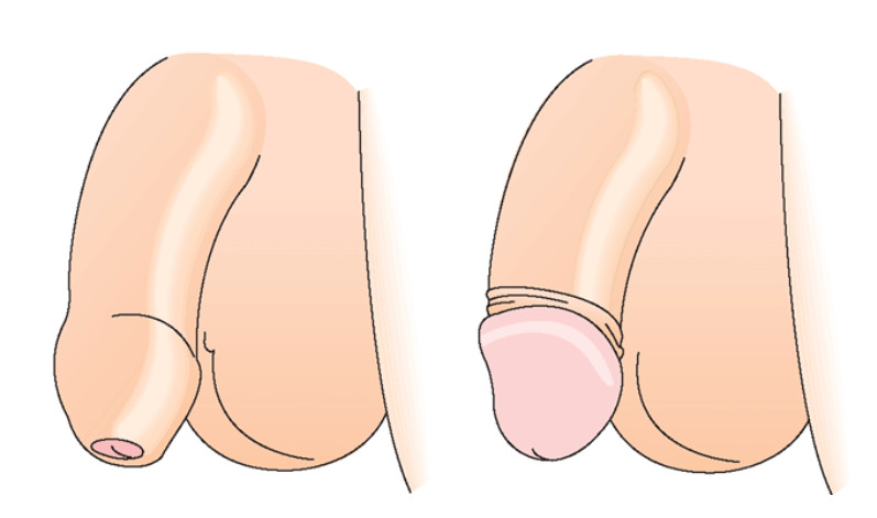 Изображение 5 Изображение 5