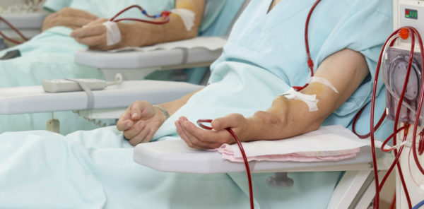 Что такое гемодиализ?