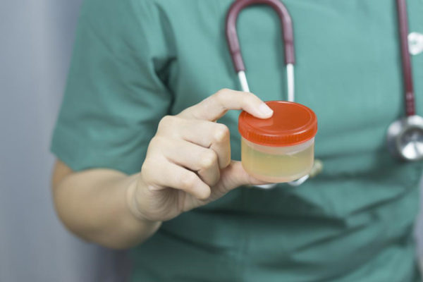 Как хранить мочу до сдачи на анализ