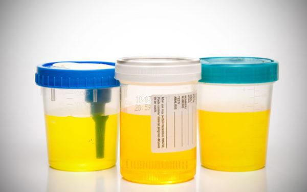 Трехстаканная проба