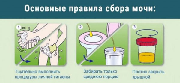 Как правильно собрать мочу для анализа