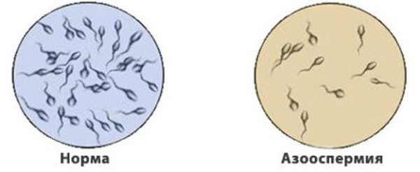 сперма