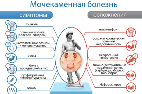 Мочекаменная болезнь симптомы и осложнения