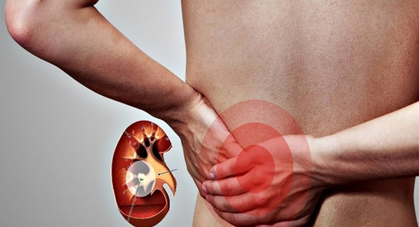 Определение куда отдается боль