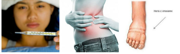 Дополнительные признаки заболеваний почек