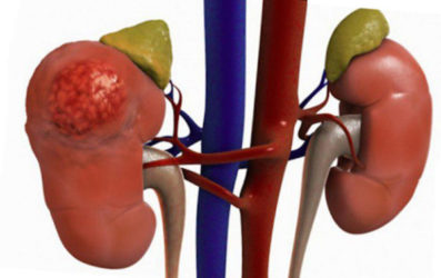 Для чего применяют расчет СКФ