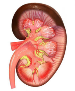 Хроническая болезнь почек