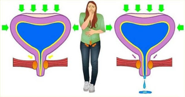 Механизм развития