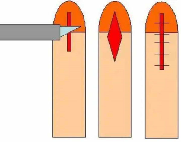 Хирургические методы лечения