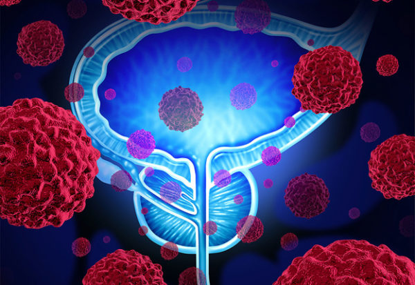 Инфекции нижних мочевых путей