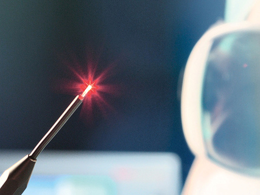 Обрезание лазером