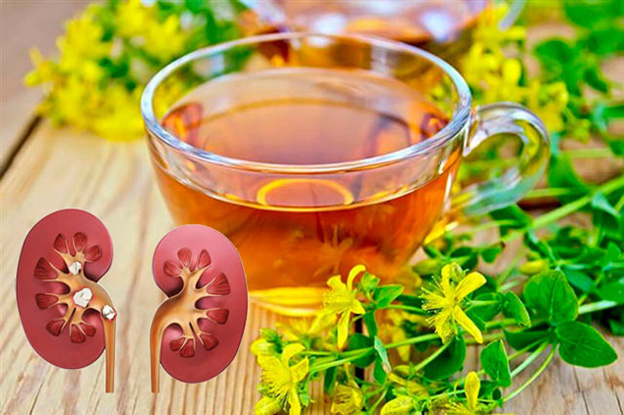 Виды камней в почках