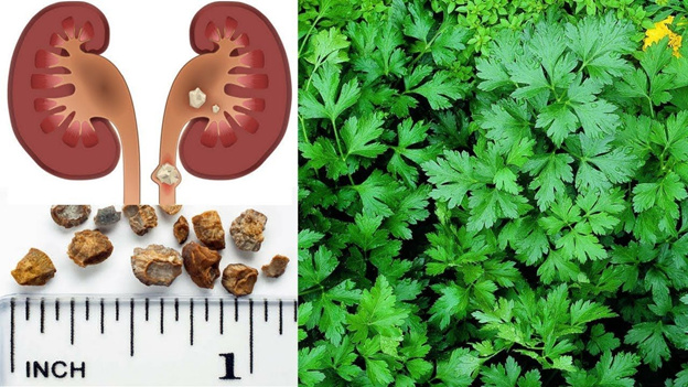 Особенности фитотерапии при камнях в почках