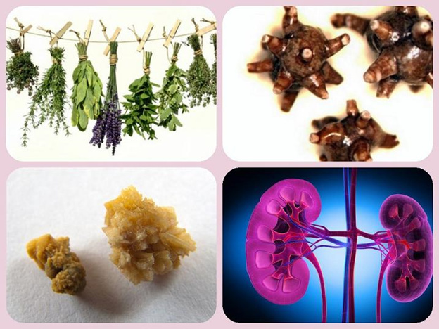 травы при нефролитиазе