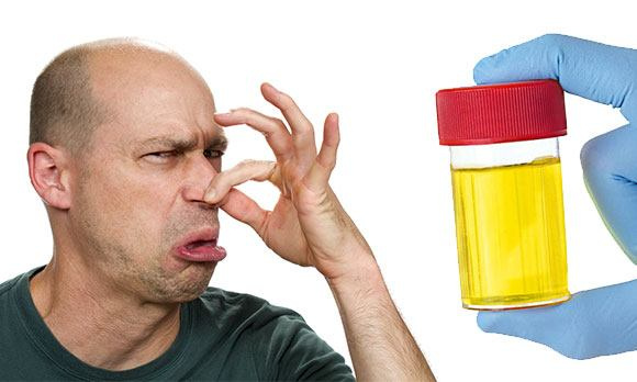 Запах мочи в норме