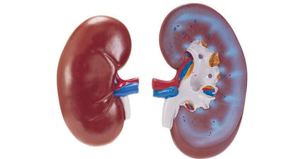 Каликоэктазия почек