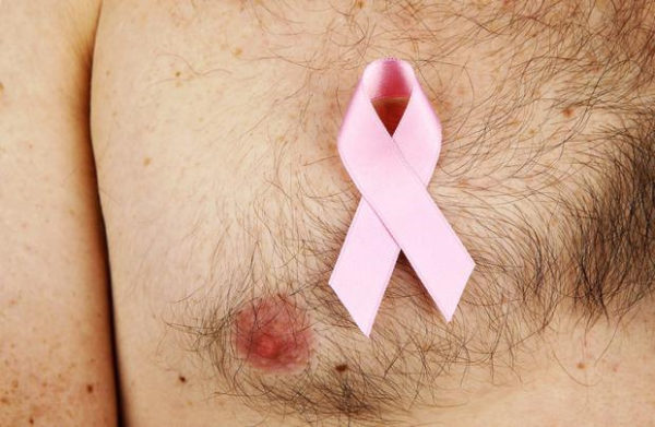 Рак грудной железы